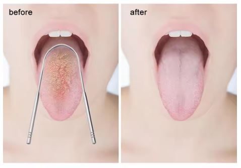 Tongue Cleaner